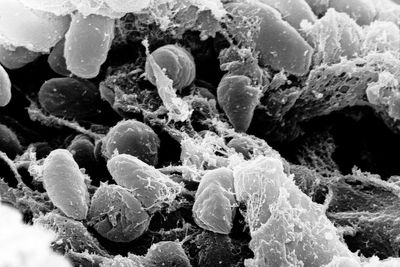 Siberia Plague Scare: Russia's Health Watchdog Says Lab Worker Who Died Had Pneumonia of Unknown Cause