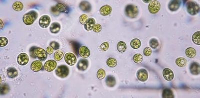 How pond algae led to a Nobel prize and a new way to study the brain