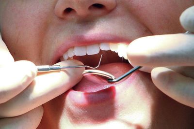 Dental patient left with costs exceeding £10,000 after multiple failed root canal treatments