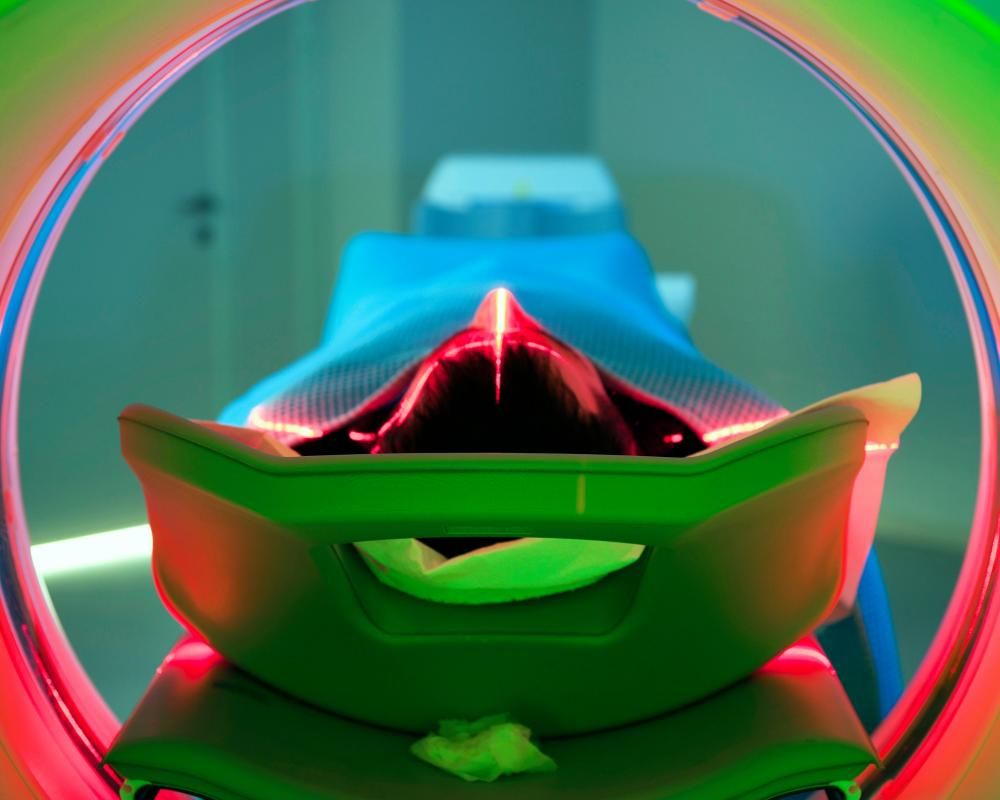 Cancer Risning Cancer rates rising more quickly among younger people,…