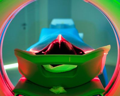Cancer rates rising more quickly among younger people, international research finds