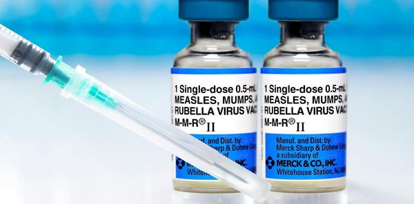 Measles is spreading across the US – and officials can’t agree on the death toll
