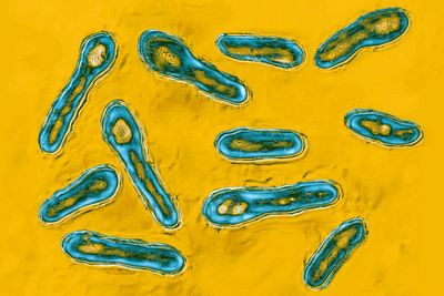 New York City med spa owner admits to giving client botulism with bootleg Botox