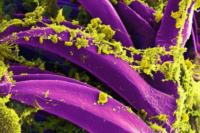 Second Death Reported at Siberian Hospital Where Plague Lab Worker Died as Moscow Denies Outbreak
