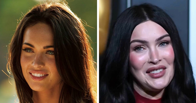 Megan Fox Leaves Fans Horrified With Appearance As They Demand To Know “What Happened”