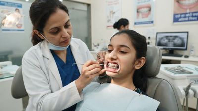 A Snail-Shaped Wire Loop Closed a Teen's Extraction Gaps and Pulled Her Protruding Teeth Back Without Bone Screws