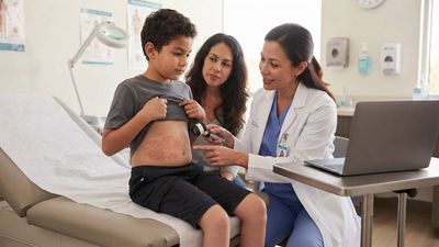 A Boy's Bruise-Like Belly Rash Sent Doctors Hunting for a Liver Injury, but the Real Culprit Was His Laptop