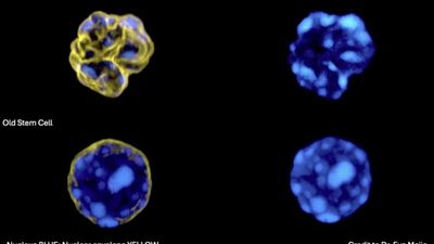 Barcelona team develops AI that detects ageing in blood stem cells