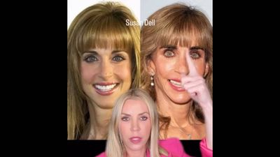 'Is that you': Celebrity cosmetic doctor reacts as Internet can't stop talking about Susan Dell's face while she donates billions