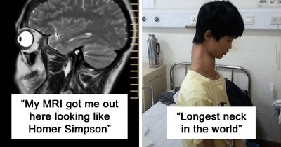 44 Medical Photos And Stories That Make TV Hospital Shows Look Surprisingly Tame