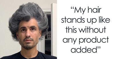 66 Cool Pics Of Unusual Body Traits And Conditions People Have