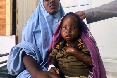 Mother's 3-day walk with sick daughter highlights Somalia's child malnutrition emergency