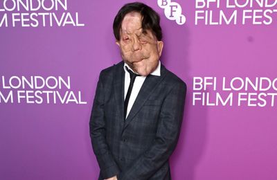 Adam Pearson hails positive disability representation progress in film industry