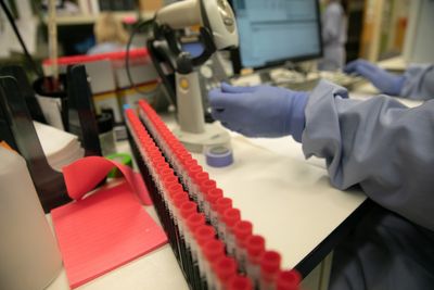 Argenx Stops Phase 3 Vyvgart Trial in Sjögren's Disease After Monitors Find the Study Cannot Meet Its Goal