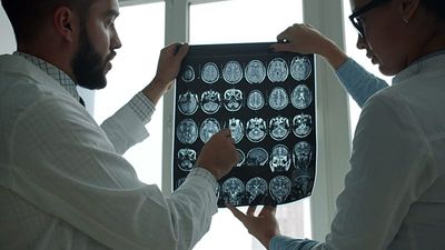 Climate change is putting Europe’s brain health at risk