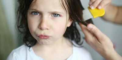 I’m a pediatrician and a mom - here’s how to treat lice without stigma