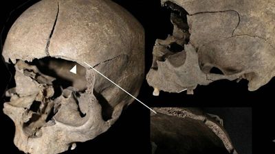 Archaeologists find 19 injuries in 12 people buried in Iron and Viking Age Scandinavia