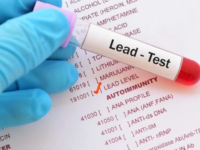 World Health Organization informs countries to improve efforts to prevent lead exposure