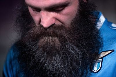 Can a Beard Take a Punch? In Lab Drop Tests, Thick Wool Cut Fake-Bone Fractures by More Than Half