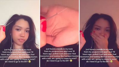 Woman gets acupuncture to help with neck pain. 10 hours later, she allegedly finds a needle in her back: ‘am I going to cease to exist?’