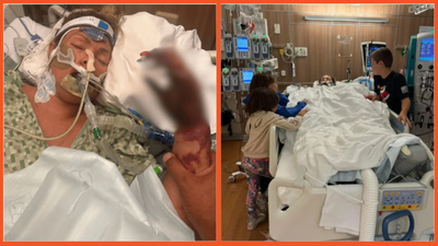 Oregon mom of 6 lost both legs and a hand after routine hysterectomy. Now she’s suing doctors, claiming their decisions left her paralyzed