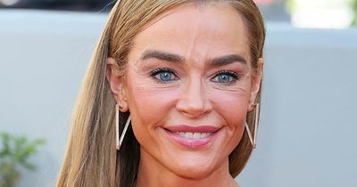 Denise Richards’ $200K Facelift Fuels ‘The Substance’ Comparisons As Before-And-After Photos Go Viral