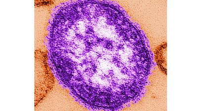 US reports 4,410 measles cases in 2026; Pennsylvania emerges as latest hotspot: CDC report