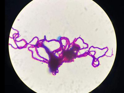 In 2018, over 6,000 volunteers examined pictures of tuberculosis bacteria exposed to drugs; their answers helped researchers test resistance to 13 medicines