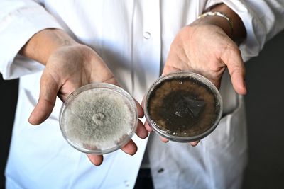Brain-Infecting Mold Detections Rose at One U.S. Lab, but 49 Cases Since 2009 Cannot Show National Risk