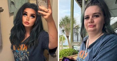 85 Photos Edited So Heavily They Started Ignoring Basic Human Anatomy