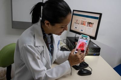 Cervical Cancer Screening Gaps Persist in the South and West as At-Home HPV Testing Expands for Women
