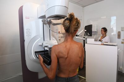 Breast Lump at 26 Revealed Cancer and a PALB2 Mutation in a Woman with No Known Family History