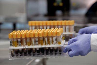 Stamford Doctor's Practices to Pay $866,539 Over Allegations They Billed Medicare and Medicaid for Blood Tests Never Run