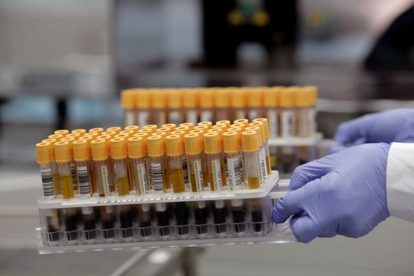 Stamford Doctor's Practices to Pay $866,539 Over Allegations They Billed Medicare and Medicaid for Blood Tests Never Run