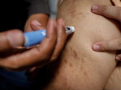 Beauty firms chase 'Ozempic face' market as weight-loss drugs boom