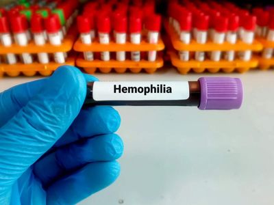 Sanofi healthcare receives CDSCO approval for Qftilia therapy for haemophilia patients in India