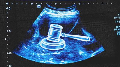 Arizona Man Awarded $67,500 on Behalf of Aborted Embryo