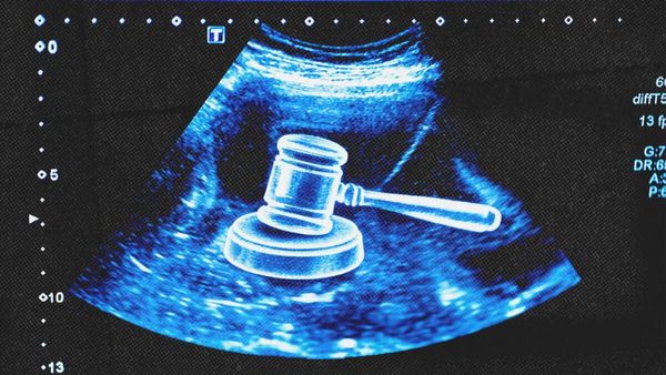 Arizona Man Awarded $67,500 on Behalf of Aborted Embryo