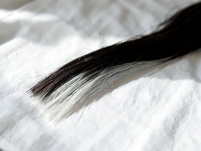 Premature Graying in Teens: 6 Health Conditions Worth Checking