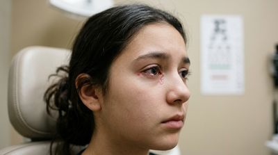 Bloody Tears Came with a Young Teen's Periods, and Doctors Suspect Endometriosis Near Her Eyes