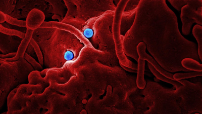 What Is Shamonda Virus? Cause, Symptoms and Vaccine Questions After First Human Case in France Ends in Death