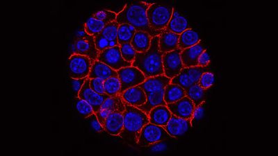 Japan's RIKEN Scientists Turn Cancer Cells' Own Gas Against Them to Make Anticancer Compounds in Lab Tests
