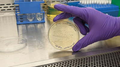 Could AI Kill Superbugs? Company Says AI-Designed Phages Given to First Patient, but Outcome Remains Unknown
