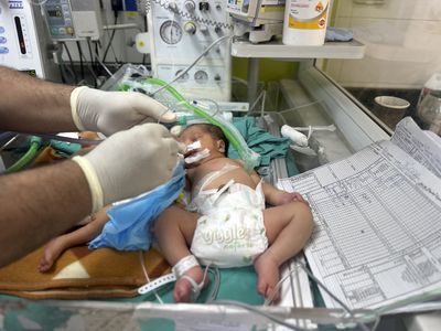 Pediatric ICU Closures in Montana, Oregon and Missouri Leave Critically Ill Children Traveling Farther for Lifesaving Care