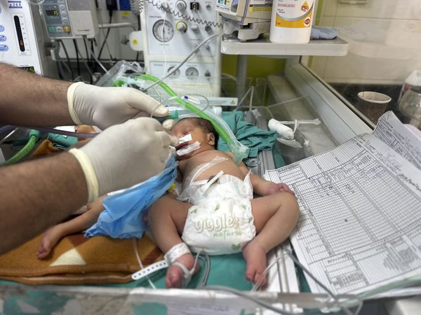 Pediatric ICU Closures in Montana, Oregon and Missouri Leave Critically Ill Children Traveling Farther for Lifesaving Care