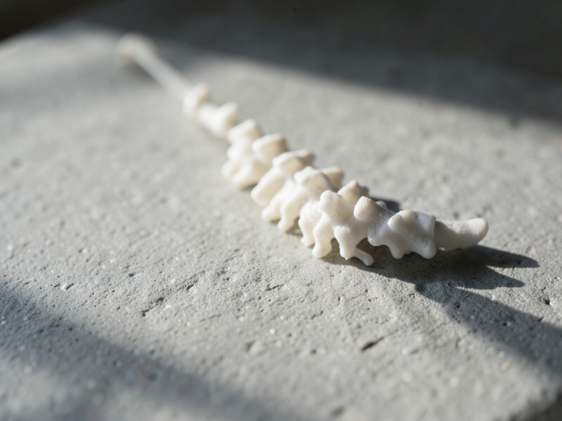 6 Reasons Most Slipped Discs Heal Without Surgery