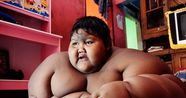  World s Fattest Boy 12 Ballooned To 30 Stone 