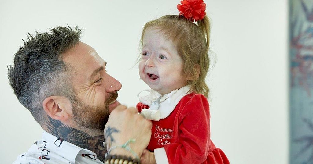 Meet the twoyearold girl Isla the world's only…