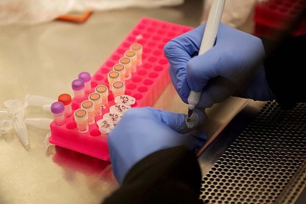 UK coronavirus patients set to trial 'promising' Japanese-made drug